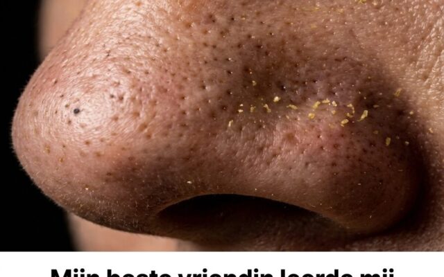 De frustratie van hardnekkige mee-eters op de neus